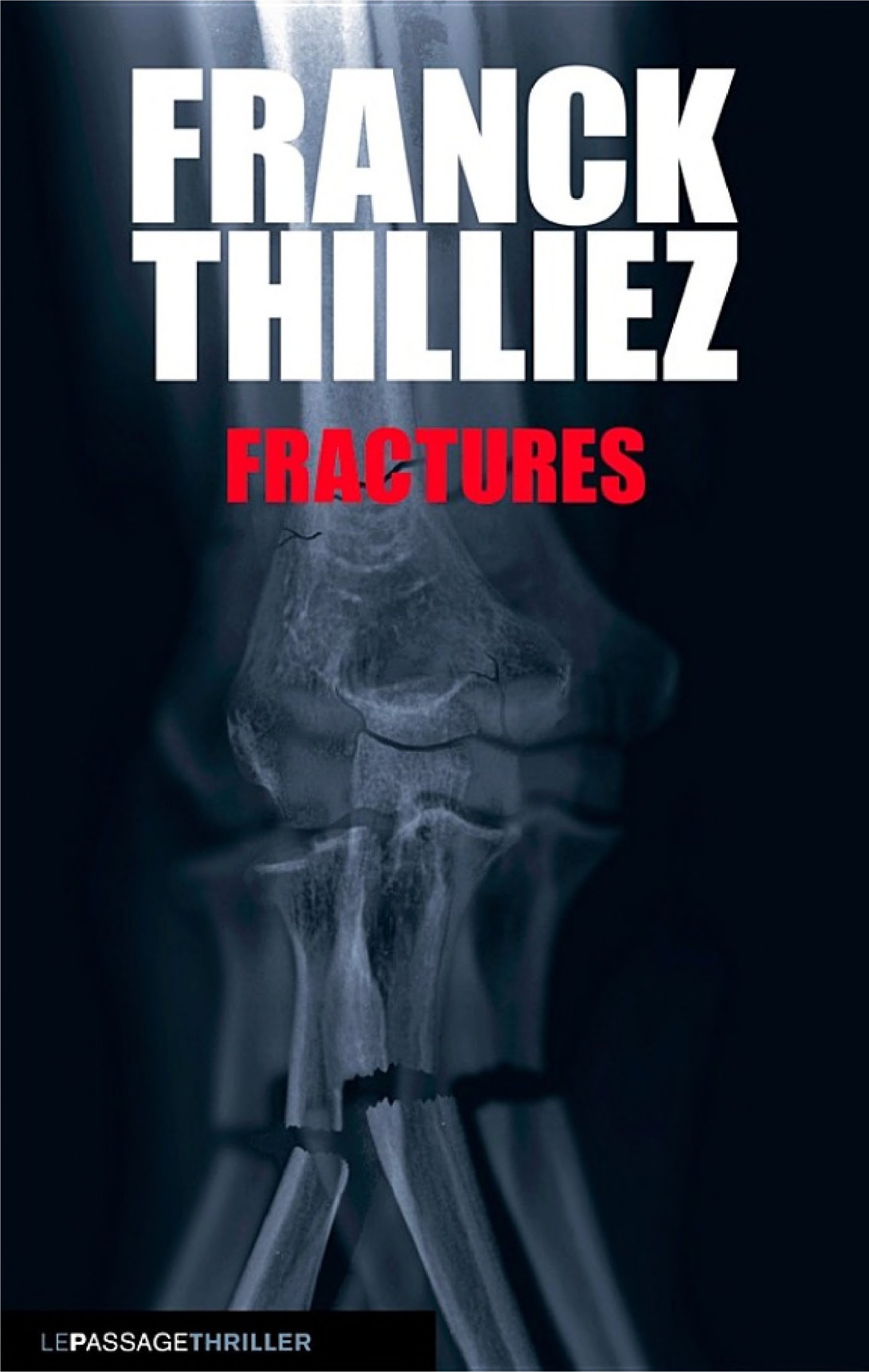 Fractures